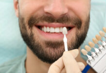 Veneers vs. Crowns: What’s the Difference and Which Do You Need? Veneers vs Crowns Whats the Difference and Which Do You Need