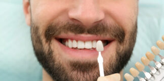 Veneers vs. Crowns: What’s the Difference and Which Do You Need? Veneers vs Crowns Whats the Difference and Which Do You Need
