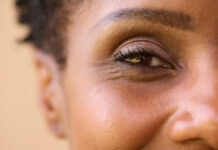 What Deficiency Causes Dark Circles Under the Eyes? What Deficiency Causes Dark Circles Under the Eyes?