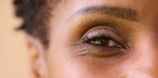 What Deficiency Causes Dark Circles Under the Eyes? What Deficiency Causes Dark Circles Under the Eyes?