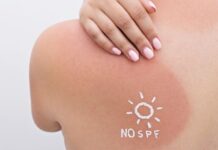 What Happens to Your Skin When You Skip Sunscreen — Every Day and Over Time What Happens to Your Skin When You Skip Sunscreen