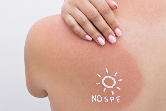 What Happens to Your Skin When You Skip Sunscreen What Happens to Your Skin When You Skip Sunscreen
