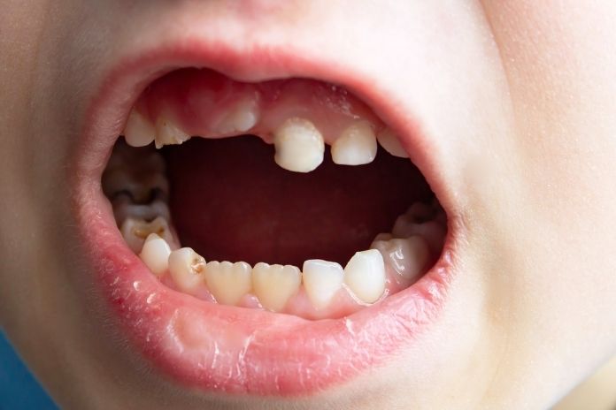 When Do Baby Teeth Come In, And What Does “Variation” Actually Mean