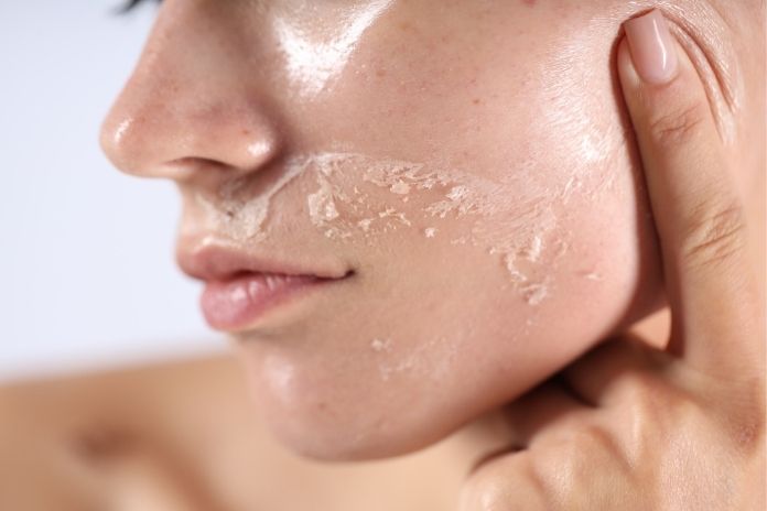 Why Menopause Affects the Skin