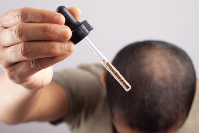 Why Researchers Are Interested in Improving Minoxidil Absorption