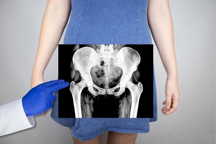 Why Tight Pelvic Floor Symptoms Are Often Misdiagnosed