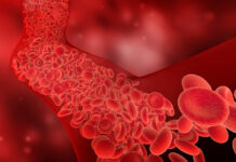8 Common Myths About Sickle Cell Disease — and What the Facts Actually Show 8 Common Myths About Sickle Cell Disease and What the Facts Actually Show