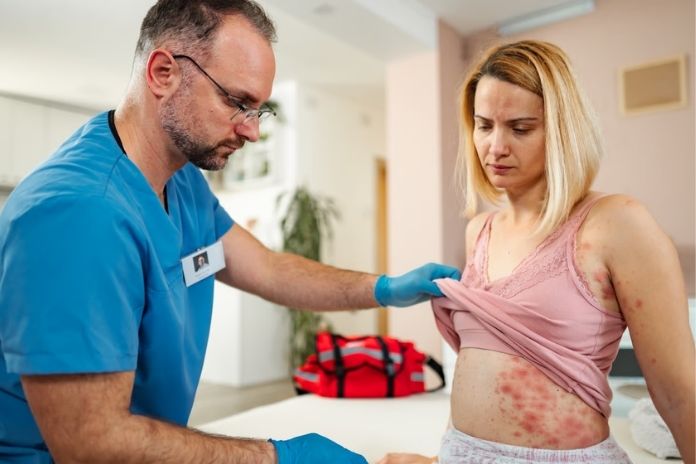 Can Early Treatment Reduce Complications of Hidradenitis Suppurativa