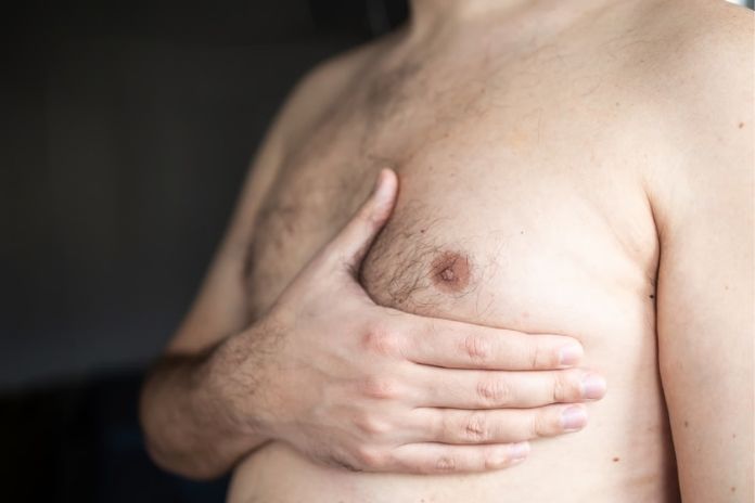 Common Symptoms of High Estrogen in Men