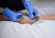 Fasting vs Non-Fasting Cholesterol Test: What’s the Difference and Does It Matter? Fasting vs Non-Fasting Cholesterol Test
