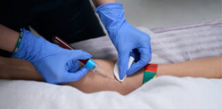 Fasting vs Non-Fasting Cholesterol Test: What’s the Difference and Does It Matter? Fasting vs Non-Fasting Cholesterol Test
