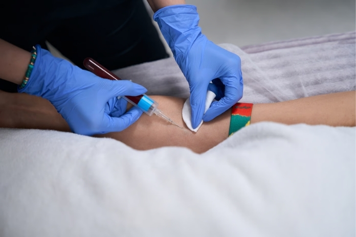Fasting vs Non-Fasting Cholesterol Test Fasting vs Non-Fasting Cholesterol Test