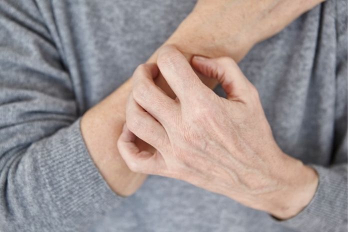 Generalized Itching Without Rash