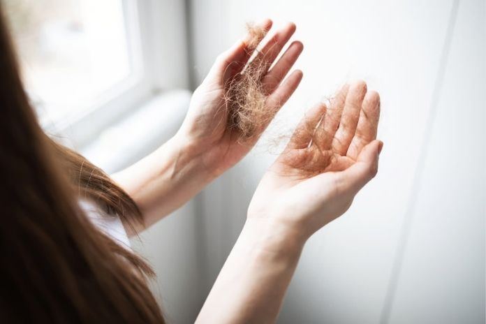 Hair Shedding vs Hair Loss How to Tell the Difference Hair Shedding vs Hair Loss How to Tell the Difference