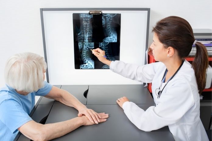 Hidden Signs of Bone Loss in Women After 40