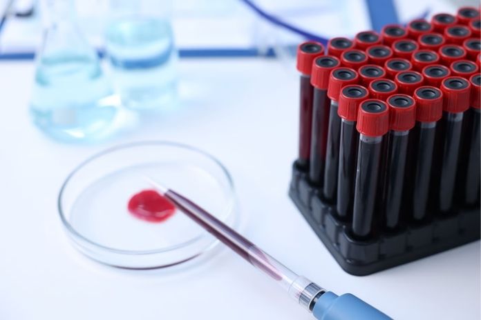 How Early Menopause Is Diagnosed