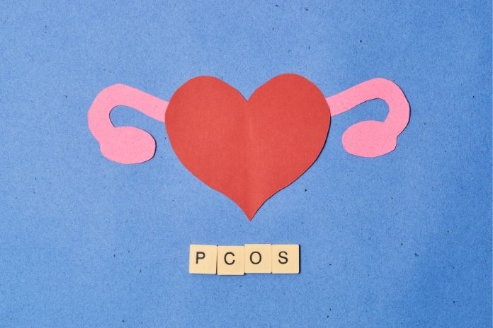 How PCOS Is Diagnosed