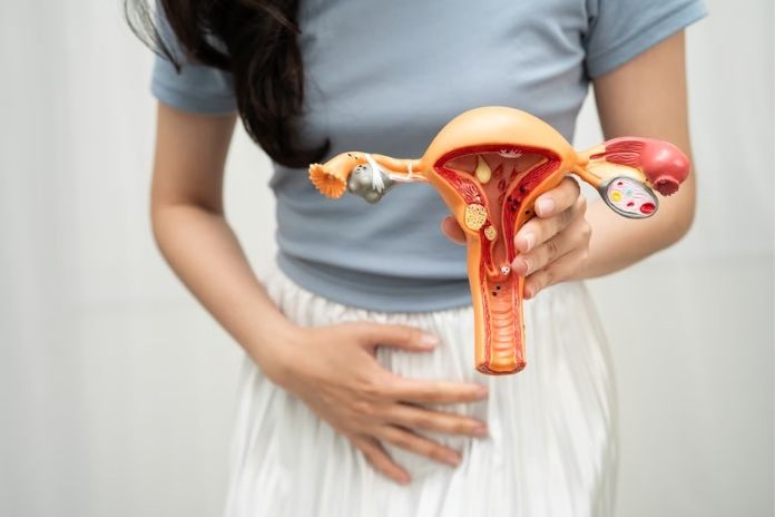 PCOS Management Beyond Ovulation