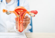 Should You Treat Polycystic Ovaries Without Symptoms? What Gynecologists Say Should You Treat Polycystic Ovaries Without Symptoms