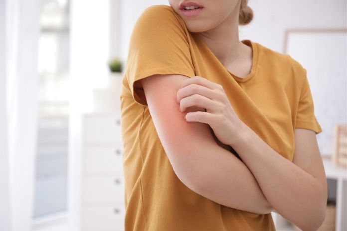 Signs You Are Not Moisturising Often Enough