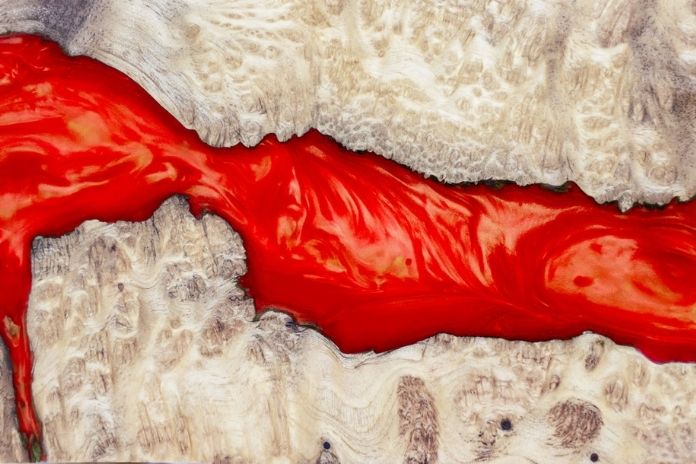 Step One LDL Enters the Artery Wall