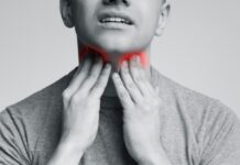 Tonsil Stones: What Causes Them, How to Remove Them, and How to Prevent Them Tonsil Stones
