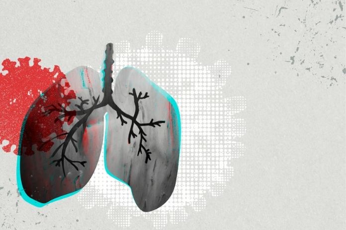 Understanding the Two Distinct Exercise Triggers