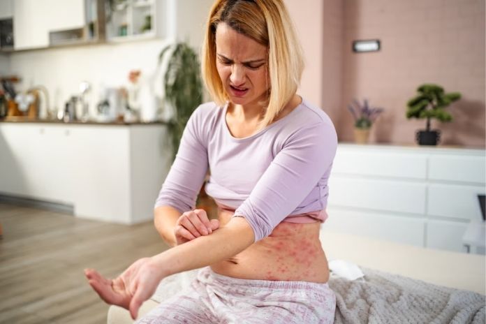 Warning Signs That HS May Be Becoming Serious