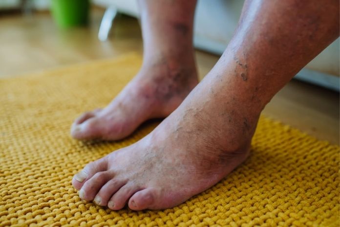Warning Signs of Heart Problems That Should Never Be Ignored