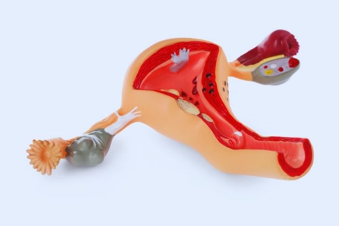 Why Menstruation Creates a Higher Infection Risk