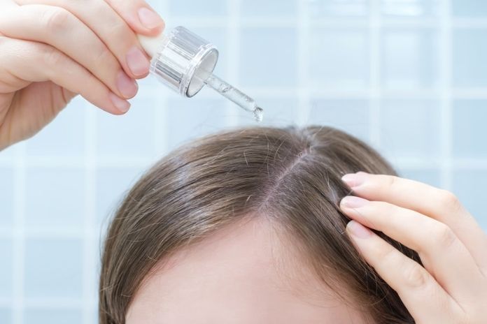 Evidence-Based Treatments for PCOS Hair Loss