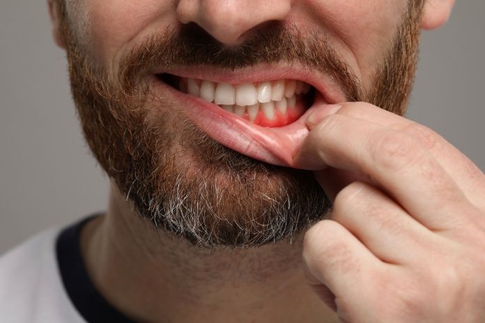 Signs Your Oral Health May Be Affecting Your Body
