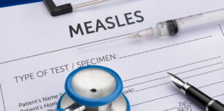 Measles Cases In The US Have Reached A 35-Year High As Outbreaks Continue To Spread Throughout The Nation Measles Cases In The US Have Reached A 35-Year High As Outbreaks Continue To Spread Throughout The Nation